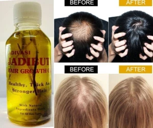 Jadibuti Oil - 3.4oz 100ML - From INDIA - Natural Hair Growth Oil USA 100% Pure - Picture 1 of 4