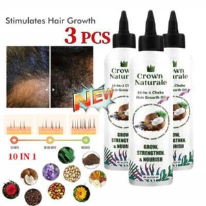 3x Crown Naturale, Crown Naturale 10 in 1 Chebe Haarwuchsöl, für schwarze Frauen - Bild 1 von 11