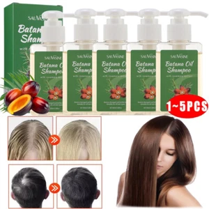 Batana Champú Aceite de Romero Champú De Batana Champú Anti-Pérdida de Cabello Champú de Romero - Imagen 1 de 28
