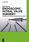 Endoscopic Mitral Valve Surgery: Handbook of Minimal-invasive Cardiac Surgery by