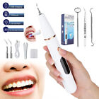 Electric LED Sonic Scaler Calculus Plaque Remover Teeth Whitening Cleaner Kit 