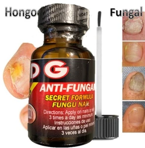 MEJOR SOPORTE DE HONGOS PARA UÑAS RÁPIDO MEJOR PRODUCTO UÑAS PUNTA RÁPIDA HONGO - Imagen 1 de 6