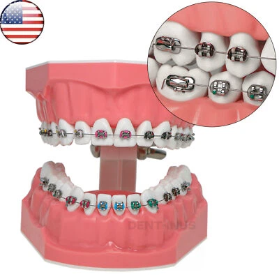 US Dental Typodont Demonstration Teeth Model with Braces For Patient Teach Study - Image 1 of 4