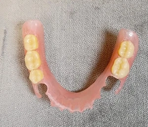 Women's Molar Teeth Lower (Partial Denture) For Collector Purposes - Picture 1 of 3