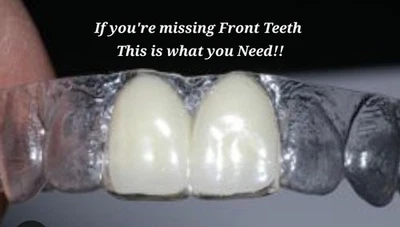 Retainer With Teeth, Affordable Way To Fill In Your Smile, with 1-3 Teeth added. - Image 1 of 4