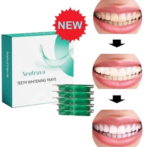 Neutrava Go Teeth Whitening Trays, Neutrava Whitening Trays, MintFlavor - Picture 1 of 10