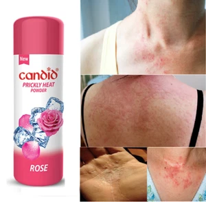 Candid Prickly Heat Powder With Rose | 120 Gm relief from itching and burning - Picture 1 of 7