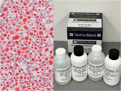 Kit de manchas O rojo aceite VitroView™ (Cat# VB-3007) Foto 1 de 4