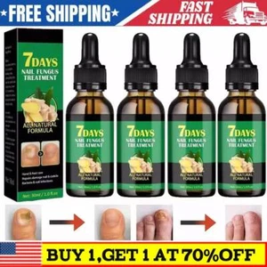 Ginger Nail Treatment Nail Care, Nail Growth Oil for Cuticle Nourishment New~~ - Picture 1 of 12