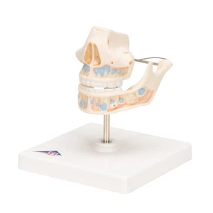 3B Scientific Milk Denture Model with Remaining Teeth Anatomical VE282 New! - Picture 1 of 1