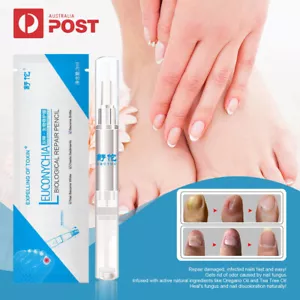 1/5x Anti Fungal Nail Treatment Finger Toe Care Nail Fungus Treatment Liquid Pen - Picture 1 of 10