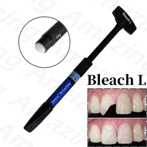 BLL Dental Tetric N-Ceram Compuesto Resina BL L Blanqueador L Color Carilla Blanqueadora - Imagen 1 de 9