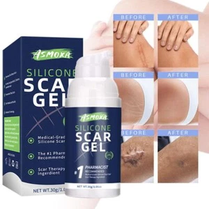 Silicone Scar Gel Stretch Marks Removal Cream Skin Care Scars Treatment Cream - Picture 1 of 9