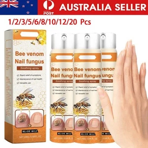 Bee Venom Nail Treatment Spray,Bee Venom Nail Fungus Soothing Spray,Relieve Nail - Picture 1 of 20