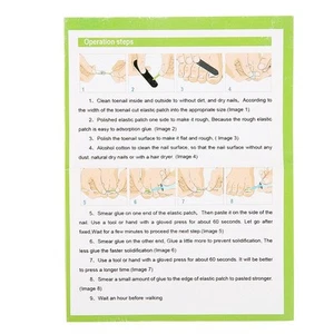 12Pcs Professional Nail Correction Sticker Pedicure Paronychia Recover Foot BX5 - Picture 1 of 15