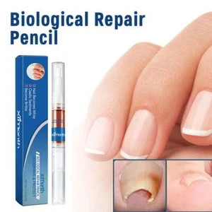 Pluma de tratamiento antifúngico para uñas cuidado de dedos de los pies hongos de uñas líquido 2024 NUEVO - Imagen 1 de 12