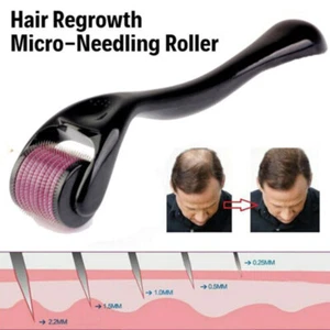 Haarwachstum Micro-Needling Roller stimuliert das Haarwachstum 540 Titan schmerzfrei - Bild 1 von 14