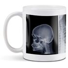 White Ceramic Mug - Radiology Doctor Hospital X-Ray Science #24453
