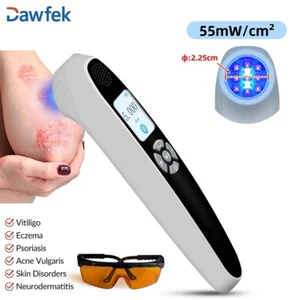 9 Diodes 55mW/cm² 308nm Excimer Skin Lightening Therapy Arm Promote Skin Repair - Picture 1 of 12