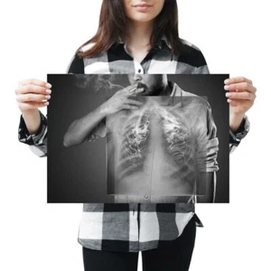 A3 - Raucher Lunge Röntgen Rauchen Wissenschaft Poster 42 x 29,7 cm 280 g/m² (BW) #43786 - Bild 1 von 4
