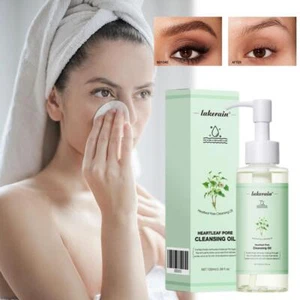 Pore Control Houttuynia Cordata Make-up-Entferner-Reinigungsöl, nicht fette B9F4 - Bild 1 von 14
