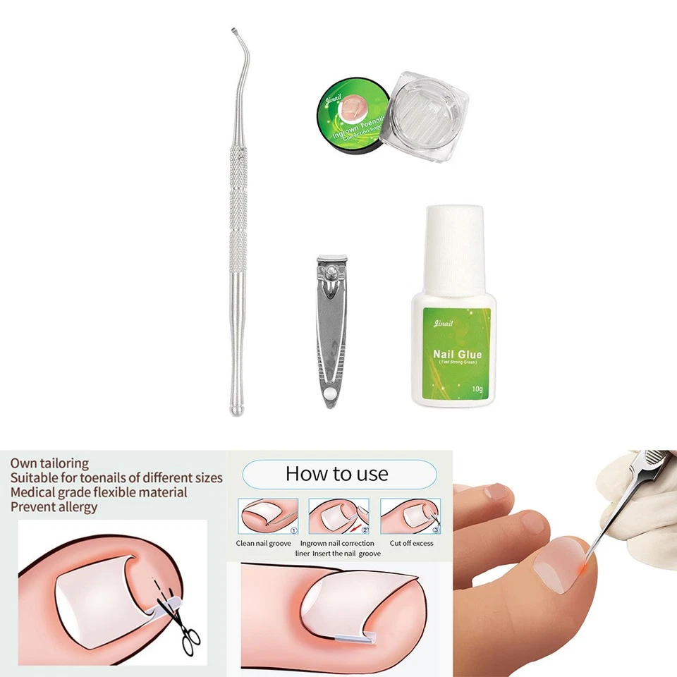 Incarnés Ongle Correction Outils Ensemble Bout Nail Nail Cleaner Soins Des - Photo 1/1