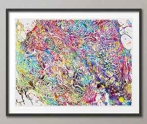 Brustkrebs Histologie Aquarelldruck Onkologe Krankenschwester Medizinische Kunst Dekor - Bild 1 von 4