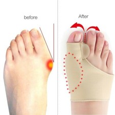 2 Hallux Valgus Bandage Zehenschutz Gelpelotte Gel Ballen Ballenschutz Korrektur