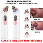 Blackheads Remover Pore Acne Rechargeable 4suctions Face Cleansing Device