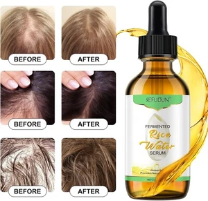 Rice Water for Hair Growth Oil 60ML Rice Oil Hair Strengthening Serum Stimulates - Picture 1 of 8