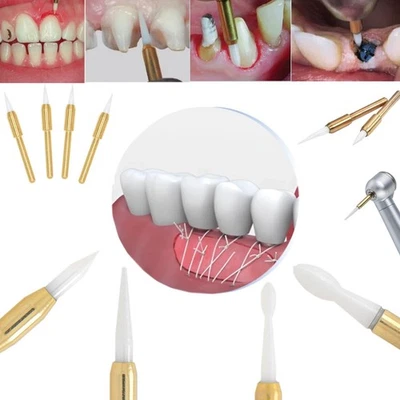 Fresas quirúrgicas dentales FG recortadoras de tejidos blandos fresas de cerámica corte preciso gingival Foto 1 de 4