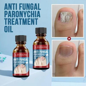 2024 Best German Toenailplus NailProp Anti Paronychia Nail Oil, Relief F5A9 - Picture 1 of 12