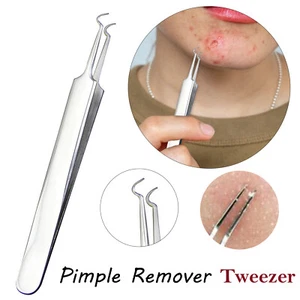 Skin Tweezer Blackhead Extractor Tool Comedone Face Acne Spot Zit Remover Steel - Picture 1 of 12
