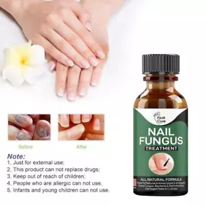 Gel de eliminación de hongos en las uñas de los pies 10/50 ml líquido reparador de uñas indoloro antiinfecciones - Imagen 1 de 10