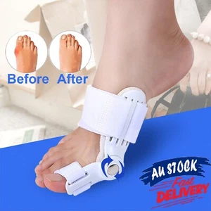 Bunion Corrector Hammer Toe Splint Straightener Orthopedic Brace Valgus Hallux - Picture 1 of 11