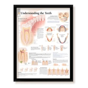 Understanding Teeth, Framed Educational Art for Offices, 22x28 Wall Diagram - Foto 1 di 5