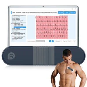 Langzeit EKG-Monitor 24Std Pulsgurt EKG Gerät Datenauswertung via KI-Algorithmus - Bild 1 von 15
