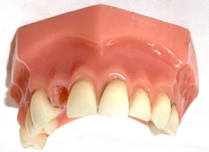 VINTAGE AUSTENAL LAB'S NY VITALLIUM DENTAL UPPER DENTURE TEACHING MODEL TEETH - Picture 1 of 6
