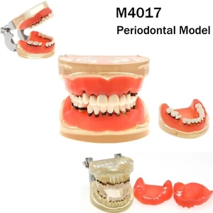 Dental Adult Periodontal Disease Pathological Teeth Model Removable Gum M4017 - Picture 1 of 17