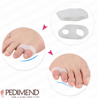 PEDIMEND™ PEDIMEND Doppelloch kleine Zehenabscheider - Vermeiden Sie Zehenquetschen & Zehendeformitäten