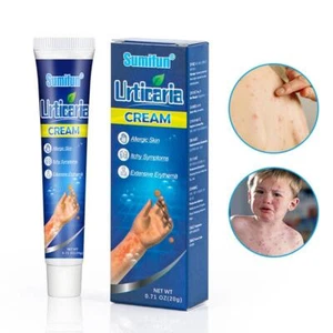 Urticaria Antipruritic Cream 20g Natural Herbal Anti US Itch Ointment X1X1 - Picture 1 of 12