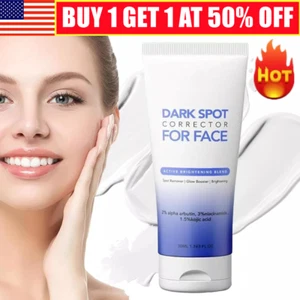 Corrector de manchas oscuras Charwee para rostro, crema removedora de manchas oscuras Charwee - Imagen 1 de 8