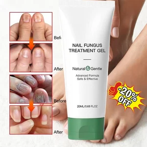 Nutraboost Nail Fungus Treatment Gel, Nail Fungus, Fungus Cream USA - Picture 1 of 17