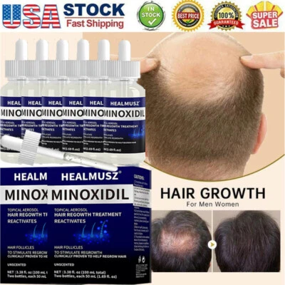 6X Minoxidil 5% Extra Strength Men Hair Regrowth Topical Solution 6 Month Supply - Image 1 of 4