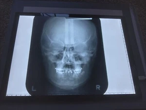 20 Human Skull X-Rays Original Medical Weird Odd Photo - Picture 1 of 4
