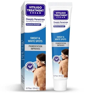 Vitiligo Treatment Vitiligo Cream Improve Skin Pigmentation & Reduces White Spot - Picture 1 of 8