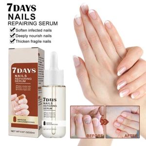 20g Nail Care Repairing Essence Fluid 7 Days Nail Growth and Strengthening Serum - Picture 1 of 13
