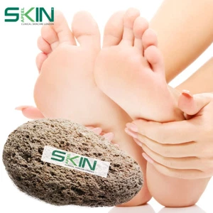 Large Pumice Stone Natural Foot Care Scrubber Dead Hard Skin Callus Remover Tool - Picture 1 of 13