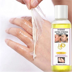 118ml Strong Yellow Peeling Oil Exfoliating Solution Dark Body Skin~ UK Z6B1 - Picture 1 of 12