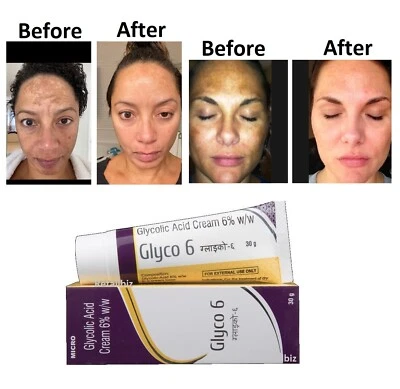GLYCO 6 GLYCOLIC ACID CREAM 6% (30GMS) + FS - Image 1 of 4